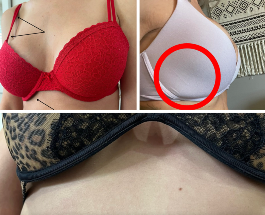 Boob Jobs & Bra Betrayal