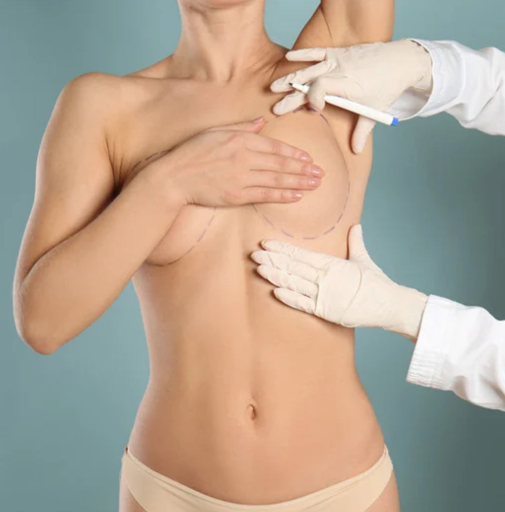 Understanding Breast Implant Placement